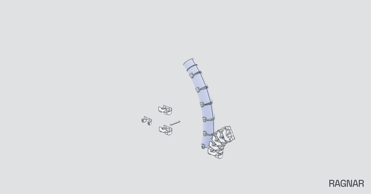 Endoscope Hinge Segment